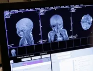 Medical imaging assets